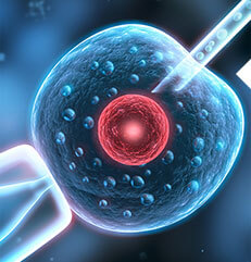 單精子卵胞漿顯微注射